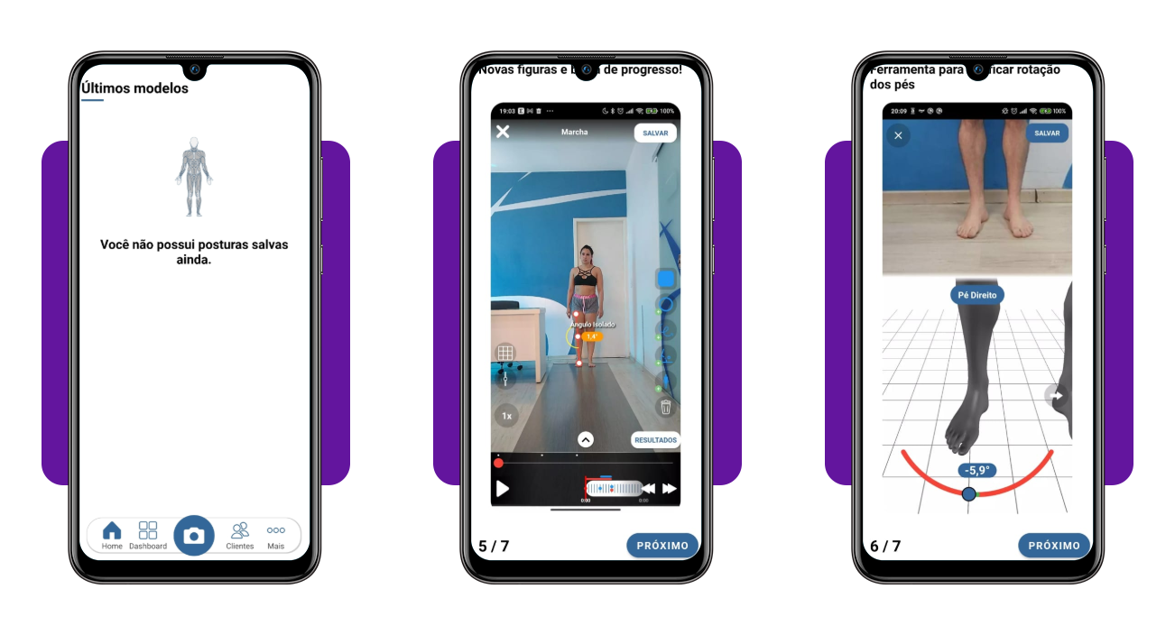 App para escanear a postura corporal com uma foto pelo celular 4 IMG 4180 03